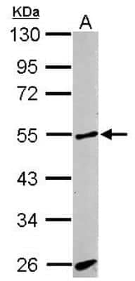 Western Blot: ALK-1 Antibody [NBP1-30982]