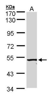 Western Blot: ALK-1 Antibody [NBP1-30982]