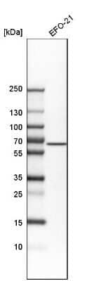 Western Blot: ALK-1 Antibody [NBP1-90254]