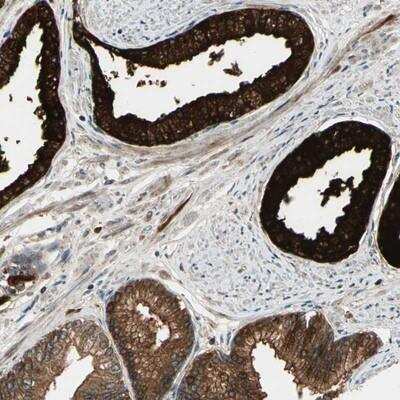 Immunohistochemistry-Paraffin: ALK-7/Activin Receptor Type 1C Antibody [NBP1-90253]