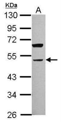 Western Blot: ALK-7/Activin Receptor Type 1C Antibody [NBP2-15272]