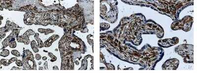 Immunohistochemistry-Paraffin: ALK-1 Antibody (MM0015-8G33) - Azide and BSA Free [NB110-85462]