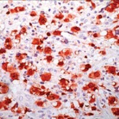 Immunohistochemistry-Paraffin: NPM-ALK Antibody (5A4) [NB120-17127]