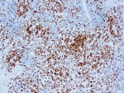 Immunohistochemistry-Paraffin: NPM-ALK Antibody (5A4) [NB120-17127]