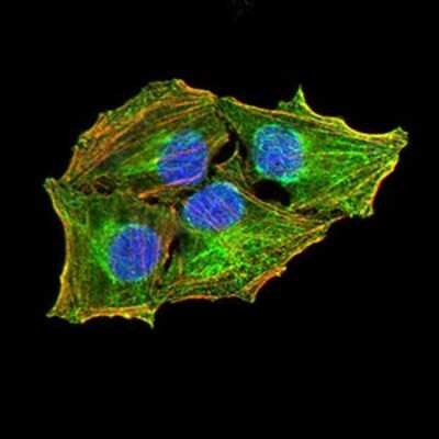 Immunocytochemistry/ Immunofluorescence: ALK/CD246 Antibody (7A11A4) - BSA Free [NBP2-61845]
