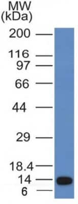 Western Blot: ALK/CD246 Antibody (ALK/1031)Azide and BSA Free [NBP3-08771]