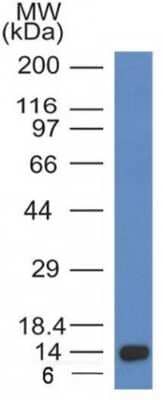 Western Blot: ALK/CD246 Antibody (ALK/1032)Azide and BSA Free [NBP3-08772]