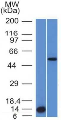 Western Blot: ALK/CD246 Antibody (ALK/1503) [NBP2-53253]