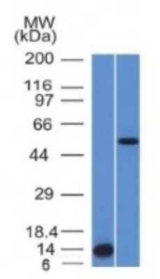 Western Blot: ALK/CD246 Antibody (ALK/1503)Azide and BSA Free [NBP2-54375]