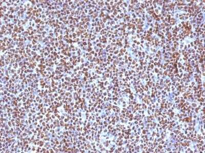 Immunohistochemistry-Paraffin: ALK/CD246 Antibody (ALK/1504) - Azide and BSA Free [NBP3-08446]