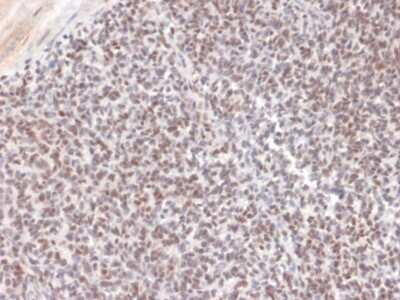 Immunohistochemistry-Paraffin: ALK/CD246 Antibody (ALK/1504) - Azide and BSA Free [NBP3-08446]