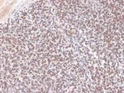 Immunohistochemistry-Paraffin: ALK/CD246 Antibody (ALK/1504) [NBP3-07771]