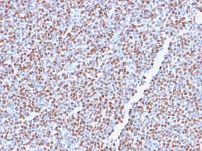 Immunohistochemistry-Paraffin: ALK/CD246 Antibody (ALK1/2766R) [NBP3-07772]