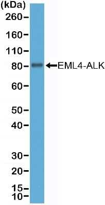 Western Blot: ALK/CD246 Antibody (RM361) [NBP2-77424]