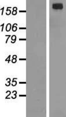 Western Blot: ALK/CD246 Overexpression Lysate [NBP2-07883]