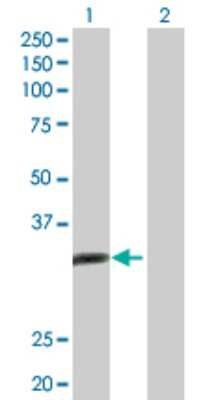 Western Blot: ALKBH3 Antibody [H00221120-D01P]