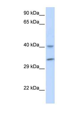 Western Blot: ALKBH3 Antibody [NBP1-57586]