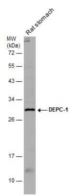 Western Blot: ALKBH3 Antibody [NBP3-12996]