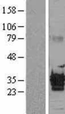 Western Blot: ALKBH3 Overexpression Lysate [NBL1-07474]