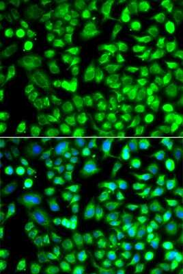 Immunocytochemistry/ Immunofluorescence: ALKBH4 Antibody - BSA Free [NBP2-92607]