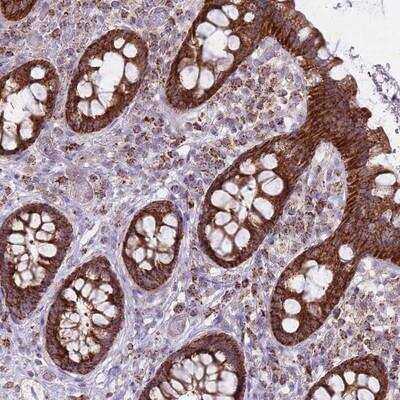 Immunohistochemistry-Paraffin: ALKBH4 Antibody [NBP2-14737]