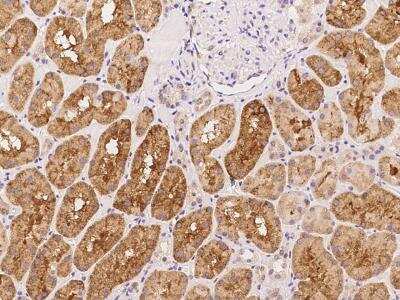 Immunohistochemistry-Paraffin: ALKBH4 Antibody [NBP3-06195]