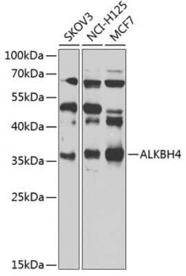 Western Blot: ALKBH4 AntibodyBSA Free [NBP2-92817]