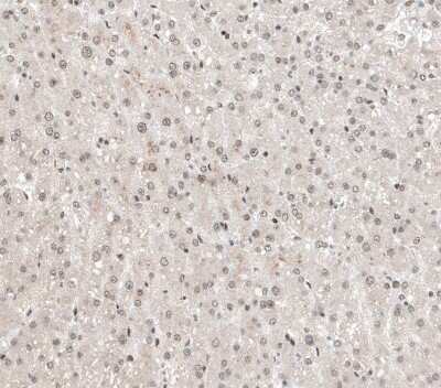 Immunohistochemistry-Paraffin: ALKBH5 Antibody [NBP1-82188]