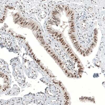 Immunohistochemistry-Paraffin: ALKBH5 Antibody [NBP1-82188]