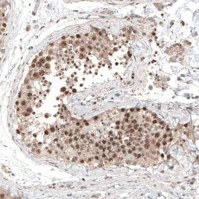Immunohistochemistry-Paraffin: ALKBH5 Antibody [NBP1-82188]