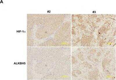 Immunohistochemistry-Paraffin: ALKBH5 Antibody [NBP1-82188]