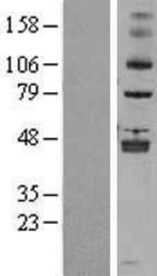 Western Blot: ALKBH5 Overexpression Lysate [NBL1-07476]