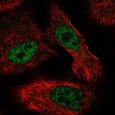 Immunocytochemistry/ Immunofluorescence: ALKBH6 Antibody [NBP2-57047]