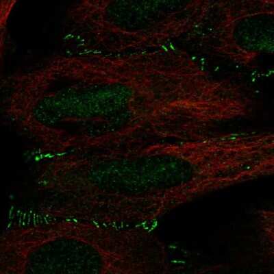 Immunocytochemistry/ Immunofluorescence: ALKBH6 Antibody [NBP2-57580]