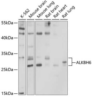 Western Blot: ALKBH6 AntibodyBSA Free [NBP3-05187]