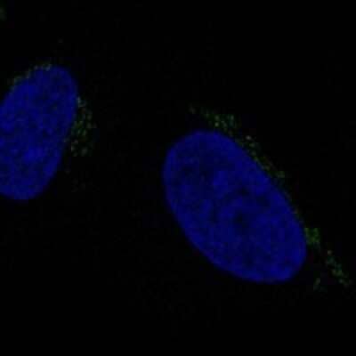 Immunocytochemistry/ Immunofluorescence: ALKBH7 Antibody [NBP3-17280]