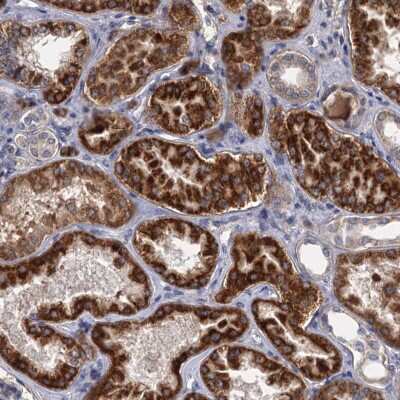 Immunohistochemistry: ALKBH7 Antibody [NBP2-38450]