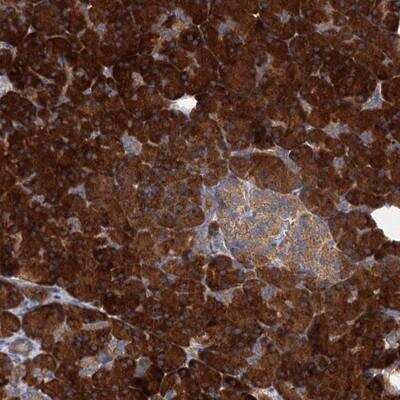 Immunohistochemistry-Paraffin: ALKBH7 Antibody [NBP1-81231]