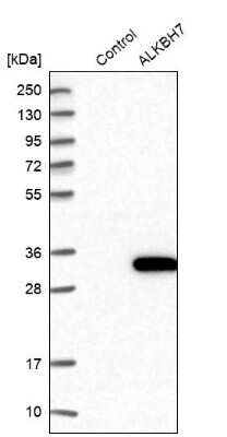 Western Blot: ALKBH7 Antibody [NBP2-38450]