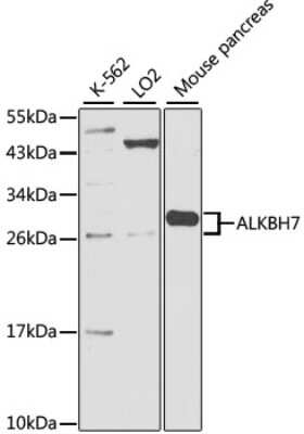 Western Blot: ALKBH7 AntibodyBSA Free [NBP2-92409]