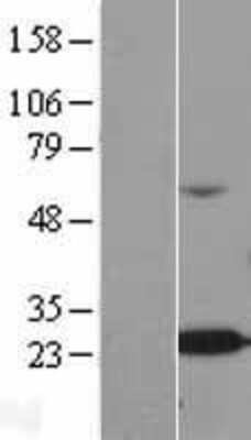 Western Blot: ALKBH7 Overexpression Lysate [NBL1-07477]