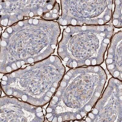 Immunohistochemistry-Paraffin: ALKBH8 Antibody [NBP1-81238]