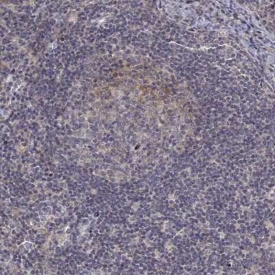Immunohistochemistry-Paraffin: ALKBH8 Antibody [NBP2-38928]