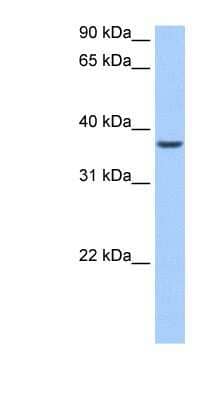 Western Blot: ALKBH8 Antibody [NBP1-80473]