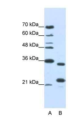 Western Blot: ALKBH8 Antibody [NBP1-80474]