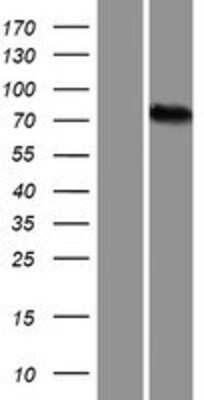 Western Blot: ALKBH8 Overexpression Lysate [NBP2-10239]