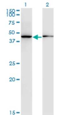 Western Blot: ALLC Antibody (3D3) [H00055821-M07]