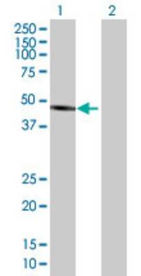 Western Blot: ALLC Antibody [H00055821-B01P]