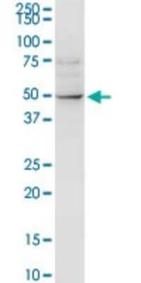 Western Blot: ALLC Antibody [H00055821-D01P]