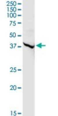 Western Blot: ALLC Antibody [H00055821-D01P]